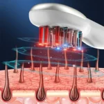 Led Light Therapy Comb For Hair Growth 204495